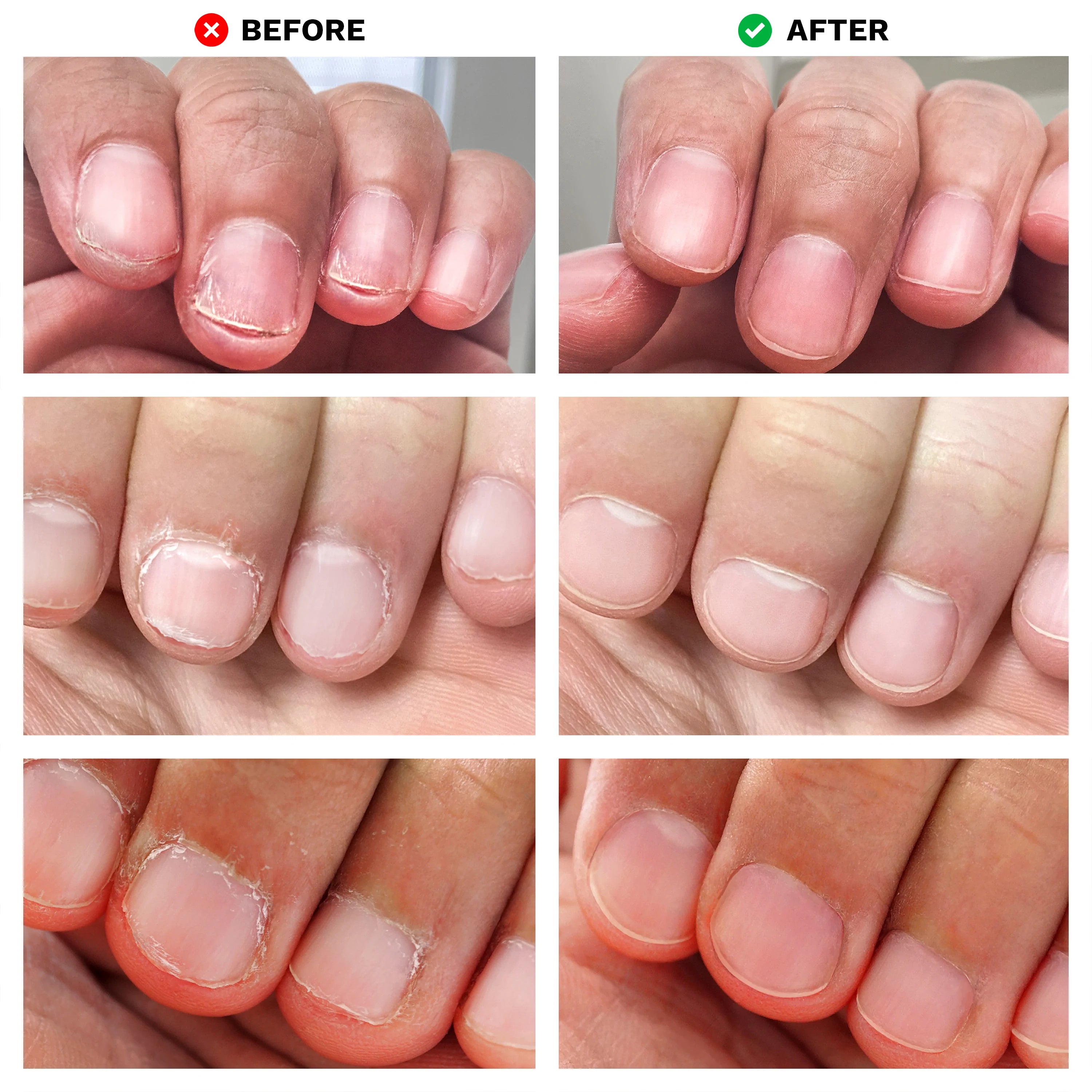  No Bite Nail Recovery by LONDONTOWN LONDONTOWN Perfumarie